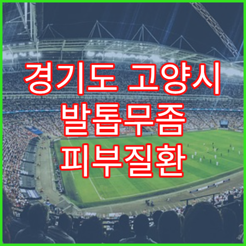경기도 고양시 발톱무좀 피부질환 치료 클리닉